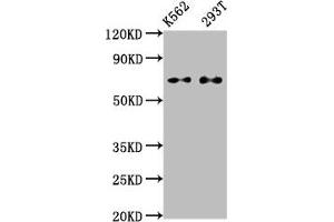 Western Blot Positive WB detected in: K562 whole cell lysate, 293T whole cell lysate All lanes: ATF2 antibody at 1. (Recombinant ATF2 antibody)