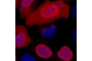Immunofluorescent analysis of Myc-tag staining in 293T cells transfected with a Myc-tag protein. (Myc Tag antibody)