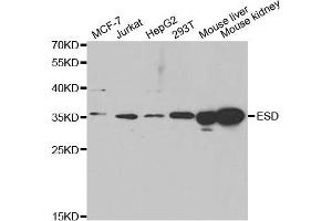 Western Blotting (WB) image for anti-Esterase D (ESD) antibody (ABIN1882355) (Esterase D antibody)