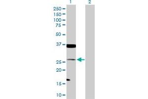 Western Blot analysis of TAGLN expression in transfected 293T cell line by TAGLN MaxPab polyclonal antibody. (Transgelin antibody  (AA 1-201))