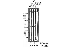 Western Blotting (WB) image for anti-Protein Phosphatase 1, Regulatory (Inhibitor) Subunit 1B (PPP1R1B) (pThr75) antibody (ABIN6255735)