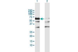 Western Blot analysis of GAD2 expression in transfected 293T cell line by GAD2 MaxPab polyclonal antibody.