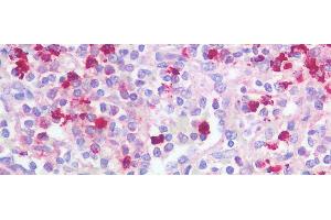 Immunohistochemistry (IHC) image for anti-Elastase, Neutrophil Expressed (ELANE) (AA 30-247) antibody (ABIN7431269)
