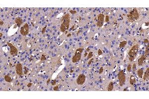 Detection of MOG in Mouse Cerebrum Tissue using Polyclonal Antibody to Myelin Oligodendrocyte Glycoprotein (MOG)
