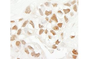 anti-Peptidylprolyl Isomerase G (Cyclophilin G) (PPIG) (AA 450-500) antibody