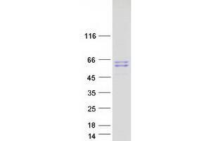 Validation with Western Blot (D2HGDH Protein (Myc-DYKDDDDK Tag))