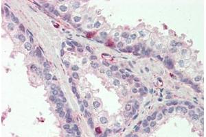 Human Prostate: Formalin-Fixed, Paraffin-Embedded (FFPE) (CCDC90A antibody  (AA 252-301))