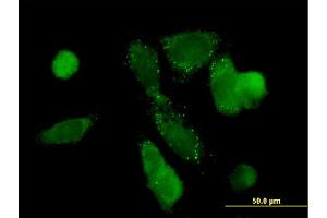 Immunofluorescence of monoclonal antibody to PCK1 on HepG2 cell. (PCK1 antibody  (AA 1-622))