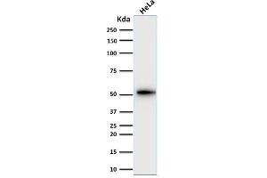 Western Blot Analysis of human HeLa cell lysate using Cytokeratin-7 Mouse Monoclonal Antibody (KRT7/2200).