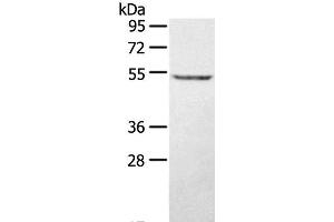 Western Blot analysis of A431 cell using STYK1 Polyclonal Antibody at dilution of 1:500 (STYK1 antibody)
