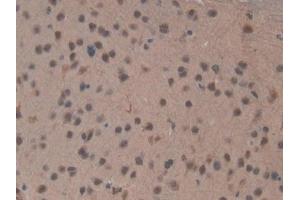 Detection of TOP2b in Mouse Brain Tissue using Polyclonal Antibody to Topoisomerase II Beta (TOP2b) (TOP2B antibody  (AA 446-655))