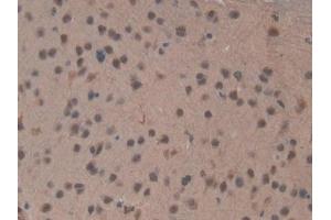Detection of TOP2b in Mouse Brain Tissue using Polyclonal Antibody to Topoisomerase II Beta (TOP2b)