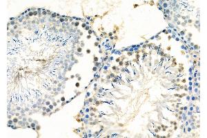 anti-TYRO Protein tyrosine Kinase Binding Protein (TYROBP) (C-Term) antibody
