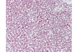 Anti-CXCL14 antibody IHC of human spleen. (CXCL14 antibody  (C-Term))