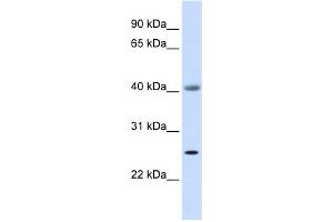WB Suggested Anti-ADA Antibody Titration: 0. (ADA antibody  (Middle Region))