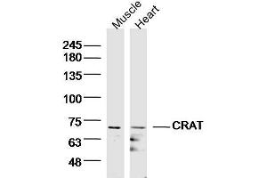 Lane 1: Mouse muscle lysates, Lane 2: mouse heart lysates probed with CRAT/CAT1 Polyclonal Antibody, Unconjugated  at 1:300 overnight at 4˚C. (CRAT antibody  (AA 301-400))