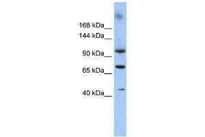 Western Blotting (WB) image for anti-Terminal Uridylyl Transferase 1, U6 SnRNA-Specific (TUT1) antibody (ABIN2458014) (TUT1 antibody)
