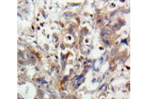 Used in DAB staining on fromalin fixed paraffin-embedded Pancreas tissue (IL28A antibody  (AA 26-200))
