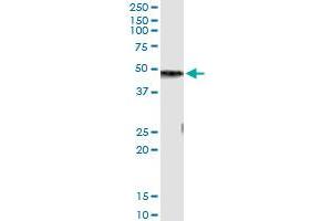 Western Blotting (WB) image for anti-Carboxypeptidase B1 (Tissue) (CPB1) (AA 14-418) antibody (ABIN598622) (CPB1 antibody  (AA 14-418))
