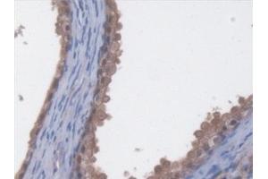 Detection of EEF2 in Human Prostate Tissue using Polyclonal Antibody to Eukaryotic Translation Elongation Factor 2 (EEF2) (EEF2 antibody  (AA 32-233))