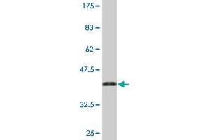 Western Blotting (WB) image for anti-Clathrin Interactor 1 (CLINT1) (AA 161-261) antibody (ABIN523164)
