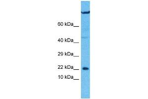 Host:  Rabbit  Target Name:  UXT  Sample Type:  U937 Whole Cell lysates  Antibody Dilution:  1. (UXT antibody  (C-Term))