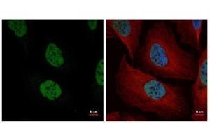 Immunofluorescence (IF) image for anti-Nuclear Mitotic Apparatus Protein 1 (NUMA1) (N-Term) antibody (ABIN2856910)