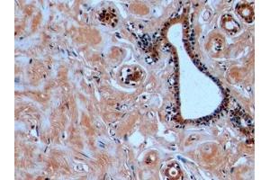 Detection of TUBb in Human Mammary gland Tissue using Monoclonal Antibody to Tubulin Beta (TUBb) (TUBB antibody  (AA 170-419))
