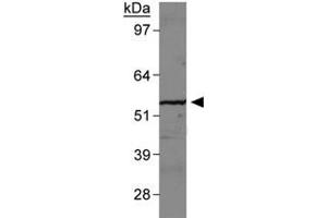 Western blot analysis of SLC2A9 in human kidney membrane with SLC2A9 polyclonal antibody . (SLC2A9 antibody  (AA 500-550))