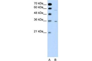 Western Blotting (WB) image for anti-G Protein-Coupled Receptor, Family C, Group 5, Member A (GPRC5A) antibody (ABIN2462428) (GPRC5A antibody)