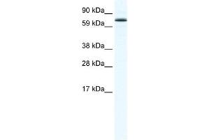 FOXO6 antibody (20R-1176) used at 0. (Foxo6 antibody  (N-Term))