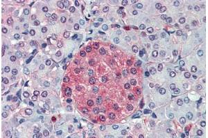 Anti-SLC11A2 antibody  ABIN960802 IHC staining of human pancreas. (SLC11A2 antibody  (C-Term))