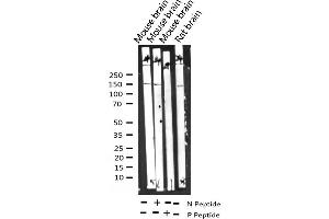 Western blot analysis of Phospho-GRF-1 (Tyr1105) expression in various lysates (GRLF1 antibody  (pTyr1105))