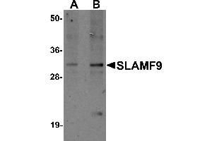Western Blotting (WB) image for anti-SLAM Family Member 9 (SLAMF9) (C-Term) antibody (ABIN1030673)