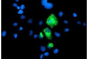 Image no. 3 for anti-Carboxypeptidase A1 (Pancreatic) (CPA1) antibody (ABIN1497590) (CPA1 antibody)