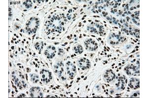 Image no. 1 for anti-Sjogren Syndrome Antigen B (SSB) antibody (ABIN1501146) (SSB antibody)