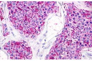 Image no. 1 for anti-Lysophosphatidic Acid Receptor 5 (LPAR5) (C-Term) antibody (ABIN1049019) (LPAR5 antibody  (C-Term))