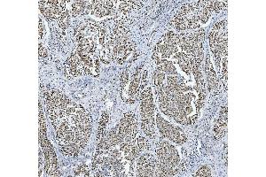 IHC analysis of TRMT6 using anti-TRMT6 antibody (ABIN7602138).