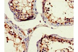 Immunohistochemistry of paraffin-embedded human testis tissue using ABIN7150275 at dilution of 1:100 (RAD54B antibody  (AA 1-167))