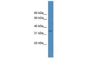 WB Suggested Anti-ELMOD1 Antibody Titration: 0. (ELMOD1 antibody  (Middle Region))