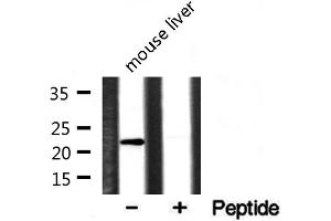 Western blot analysis of extracts of various cell lines, using CLDN1 antibody. (Claudin 1 antibody  (C-Term))