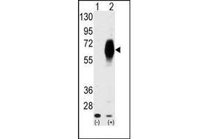 Western blot analysis of AMHR2 (arrow) using AMHR2 Antibody