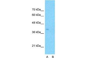 Host:  Rabbit  Target Name:  APOBEC3B  Sample Type:  HepG2  Lane A:  Primary Antibody  Lane B:  Primary Antibody + Blocking Peptide  Primary Antibody Concentration:  1ug/ml  Peptide Concentration:  5ug/ml  Lysate Quantity:  25ug/lane/lane  Gel Concentration:  0. (APOBEC3B antibody  (N-Term))
