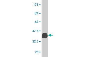 Western Blot detection against Immunogen (35. (PBX3 antibody  (AA 342-434))