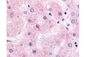 Anti-NR0B2 antibody IHC of human liver, hepatocytes.