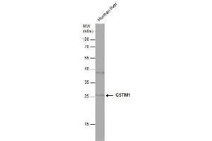WB Image Human tissue extract (30 μg) was separated by 12% SDS-PAGE, and the membrane was blotted with GSTM1 antibody , diluted at 1:1000. (GSTM1 antibody)