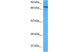 Host:  Rabbit  Target Name:  APP  Sample Tissue:  Human A172 Whole Cell lysates  Antibody Dilution:  1ug/ml (APP antibody  (Middle Region))
