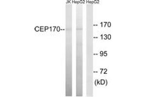 Western blot analysis of extracts from HepG2/Jurkat cells, using CEP170 Antibody. (CEP170 antibody  (AA 701-750))