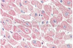 Rabbit Anti-RNH1 Antibody Catalog Number: ARP72880 Formalin Fixed Paraffin Embedded Tissue: Human Adult Heart  Observed Staining: Cytoplasm in hepatocytes Primary Antibody Concentration: 1:600 Secondary Antibody: Donkey anti-Rabbit-Cy3 Secondary Antibody Concentration: 1:200 Magnification: 20X Exposure Time: 0. (RNH1 antibody  (N-Term))