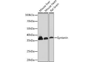 Western blot analysis of extracts of various cell lines, using Syntenin Rabbit mAb (ABIN7270680) at 1:1000 dilution. (SDCBP antibody)